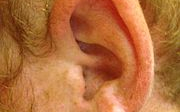 Zvětšené uzliny za uchem